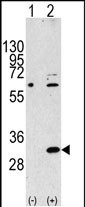 WB - EIF4E2 Antibody (N-term) AP1955a